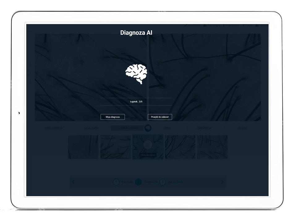 Hair Medica AI - Trichoskopia i diagnoza