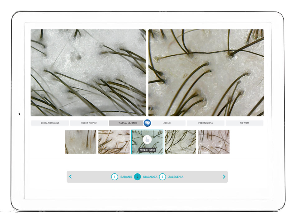 Hair Medica AI - Własna diagnoza