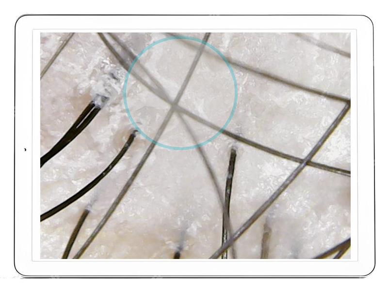 Hair Medica AI - Stan skóry głowy